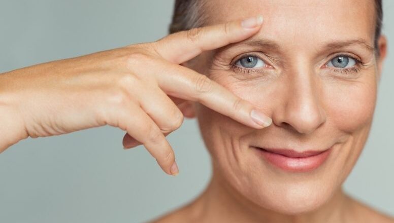 Olheiras: dermatologista explica 3 tratamentos para diminuir a pigmentação