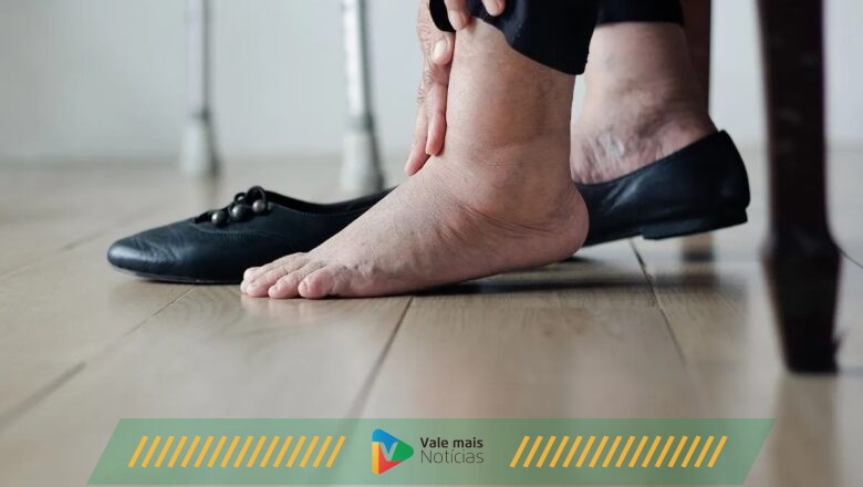 Pernas e pés inchados? Veja 5 dicas para melhorar a circulação sanguínea