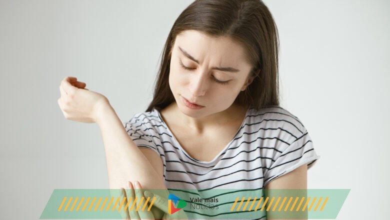 Vitamina B12 como cosmético: um aliado contra a dermatite atópica, psoríase e rosácea