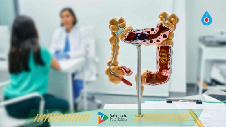 Teste revolucionário para o tratamento de câncer de intestino