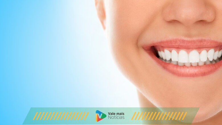 Uso exagerado de lentes nos dentes: até onde o dentista deve agradar o cliente?