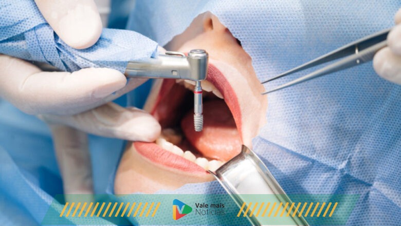Mercado de implantes deve chegar a R$ 72 milhões em 2027 e produtos com oxigênio ativo se destacam