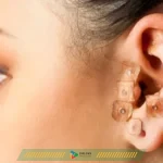 Auriculoterapia: Pequenos estímulos, grandesresultados