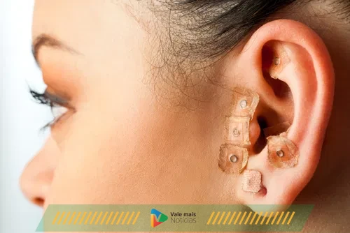 Auriculoterapia: Pequenos estímulos, grandesresultados